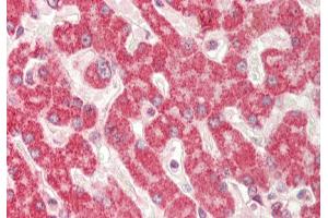 Immunohistochemistry (IHC) image for anti-Ribophorin 1 (RPN1) (Middle Region) antibody (ABIN2778827)