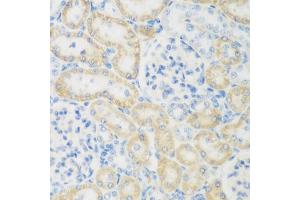 Immunohistochemistry of paraffin-embedded rat kidney using NB antibody (ABIN6132989, ABIN6144383, ABIN6144385 and ABIN6223030) at dilution of 1:200 (40x lens). (NAT8B 抗体  (AA 75-165))