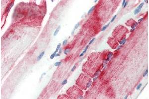 Human Skeletal Muscle (formalin-fixed, paraffin-embedded) stained with CRYAB antibody ABIN462098 at 10 µg/ml followed by biotinylated goat anti-rabbit IgG secondary antibody ABIN481713, alkaline phosphatase-streptavidin and chromogen. (CRYAB 抗体)