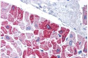 Immunohistochemistry (Paraffin-embedded Sections) (IHC (p)) image for anti-Potassium Voltage-Gated Channel, Subfamily H (Eag-Related), Member 5 (KCNH5) (AA 156-205) antibody (ABIN6736405)