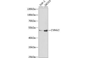 Western blot analysis of extracts of various cell lines, using CYP4V2 Antibody (ABIN6131089, ABIN6139368, ABIN6139369 and ABIN6222250) at 1:1000 dilution. (CYP4V2 抗体  (AA 246-525))