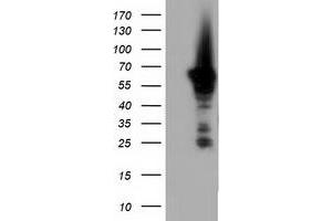 HEK293T cells were transfected with the pCMV6-ENTRY control (Left lane) or pCMV6-ENTRY AK5 (Right lane) cDNA for 48 hrs and lysed. (Adenylate Kinase 5 抗体)