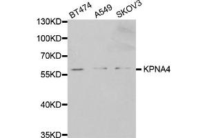 Western blot analysis of extracts of various cell lines, using KPNA4 antibody (ABIN5971058) at 1/1000 dilution. (KPNA4 抗体)