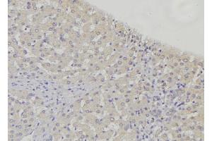 ABIN6274883 at 1/100 staining Mouse liver tissue by IHC-P. (ABCB7 抗体  (N-Term))