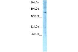 Human Jurkat; WB Suggested Anti-ZNF500 Antibody Titration: 0. (ZNF500 抗体  (Middle Region))