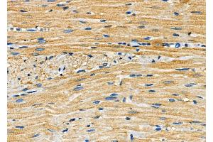 ABIN6260056 and ABIN6272251 at 1/100 staining Rat heart tissue by IHC-P. (ARRDC4 抗体  (Internal Region))