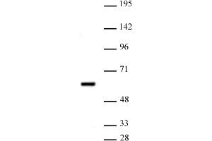 PRMT2 antibody (pAb) tested by Western blot. (PRMT2 抗体  (N-Term))
