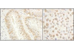 Immunohistochemistry (IHC) image for anti-General Transcription Factor IIE, Polypeptide 1, alpha 56kDa (GTF2E1) (AA 389-439) antibody (ABIN7453711)