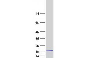 Western Blotting (WB) image for CTF8, Chromosome Transmission Fidelity Factor 8 (CHTF8) (Transcript Variant 4) protein (Myc-DYKDDDDK Tag) (ABIN2718884)