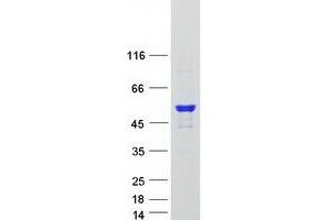Western Blotting (WB) image for rho GTPase Activating Protein 1 (ARHGAP1) protein (Myc-DYKDDDDK Tag) (ABIN2714869)