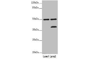 Western blot All lanes: PLIN5 antibody at 2 μg/mL Lane 1: Mouse kidney tissue Lane 2: Mouse brain tissue Secondary Goat polyclonal to rabbit IgG at 1/10000 dilution Predicted band size: 51 kDa Observed band size: 51, 36 kDa (PLIN5 抗体  (AA 305-453))