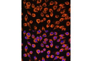 Immunofluorescence (IF) image for anti-Interleukin 23 Receptor (IL23R) (AA 405-629) antibody (ABIN3022246)