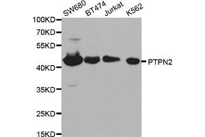 Western blot analysis of extracts of various cell lines, using PTPN2 antibody (ABIN5970915) at 1/1000 dilution. (PTPN2 抗体)