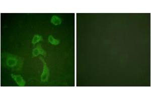 Immunofluorescence analysis of HeLa cells, using IL-2R beta (Ab-364) Antibody. (IL2 Receptor beta 抗体  (AA 331-380))