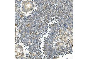 IHC analysis of Bid using anti-Bid antibody (ABIN7599062).