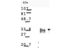 Western blot analysis is shown using  anti-Cyclin D1 antibody to detect Human Cyclin D1 present in asynchronous HN30 cell lysates.