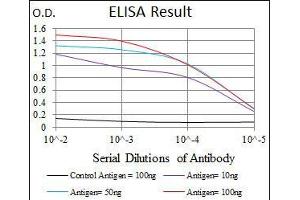 Black line: Control Antigen (100 ng), Purple line: Antigen(10 ng), Blue line: Antigen (50 ng), Red line: Antigen (100 ng), (Rab4 抗体)