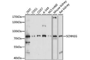 Western blot analysis of extracts of various cell lines, using SCNN1G antibody. (SCNN1G 抗体)