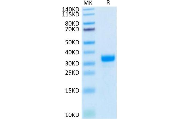 Angiopoietin 2 Protein (ANGPT2) (His-Avi Tag,Biotin)