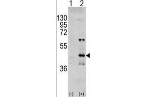 Western blot analysis of PK3 (arrow) using rabbit polyclonal PK3 Antibody  (R). (ERK1 抗体  (AA 182-211))
