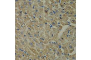 Immunohistochemistry (Paraffin-embedded Sections) (IHC (p)) image for anti-Cysteine-S-conjugate beta-Lyase (CCBL1) (AA 1-270) antibody (ABIN6138036)