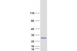 Western Blotting (WB) image for ChaC, Cation Transport Regulator Homolog 2 (CHAC2) protein (Myc-DYKDDDDK Tag) (ABIN2713953)