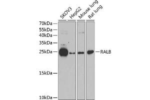 Western blot analysis of extracts of various cell lines, using RALB antibody (ABIN1682468, ABIN5664619, ABIN5664621 and ABIN6220484) at 1:1000 dilution. (RALB 抗体  (AA 1-206))