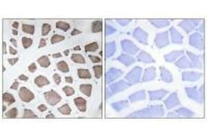 Immunohistochemistry analysis of paraffin-embedded human skeletal muscle tissue using MRPS18C antibody. (MRPS18C 抗体)
