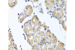 Immunohistochemistry of paraffin-embedded Human stomach using GLS Polyclonal Antibody at dilution of 1:100 (40x lens). (Glutaminase 抗体)