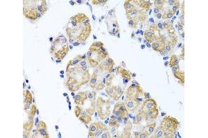Immunohistochemistry of paraffin-embedded Human stomach using GLS Polyclonal Antibody at dilution of 1:100 (40x lens). (Glutaminase 抗体)
