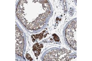 Immunohistochemical staining of human testis with WIPF3 polyclonal antibody  shows moderate cytoplasmic positivity in cells in seminiferus ducts and strong staining in Leydig cells at 1:50-1:200 dilution. (WIPF3 抗体)