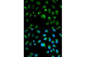 Immunofluorescence analysis of HeLa cells using TLR1 antibody. (TLR1 抗体  (AA 30-290))