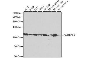 Western blot analysis of extracts of various cell lines, using SMARCA5 antibody. (SMARCA5 抗体  (AA 100-400))