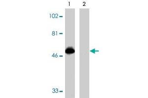 Western blot analysis using CX3CR1 polyclonal antibody  at 1 ug/mL on THP-1 cell lysate in the absence (lane 1) and presence (lane 2) of specific blocking peptide. (CX3CR1 抗体  (AA 175-189))