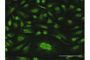 Immunofluorescence of purified MaxPab antibody to CDKN2D on HeLa cell. (CDKN2D 抗体  (AA 1-166))