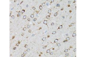 Immunohistochemistry of paraffin-embedded Rat brain using UBE2D1 Polyclonal Antibody at dilution of 1:100 (40x lens). (UBE2D1 抗体)