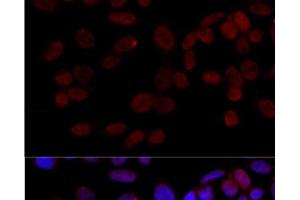 Immunofluorescence analysis of HeLa cells using JNK1 Polyclonal Antibody at dilution of 1:100 (40x lens). (JNK 抗体)