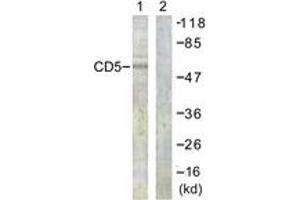 Western Blotting (WB) image for anti-CD5 (CD5) (AA 421-470) antibody (ABIN2888797) (CD5 抗体  (AA 421-470))
