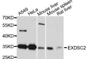 Western blot analysis of extracts of various cell lines, using EXOSC2 antibody. (EXOSC2 抗体)