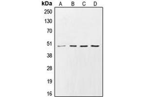 Western blot analysis of CK1 gamma 2 expression in HeLa (A), Raw264. (Casein Kinase 1 gamma 2 抗体  (N-Term))