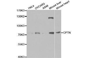 Western Blotting (WB) image for anti-Optineurin (OPTN) antibody (ABIN1874007) (OPTN 抗体)
