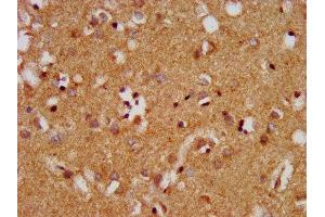IHC image of ABIN7159750 diluted at 1:400 and staining in paraffin-embedded human brain tissue performed on a Leica BondTM system. (MAP1A 抗体  (AA 1979-2168))