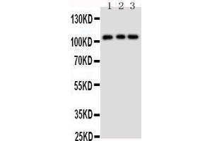 Anti-TRPC6 antibody, Western blotting Lane 1: Rat Lung Tissue Lysate Lane 2: 293T Cell Lysate Lane 3: 293T Cell Lysate (TRPC6 抗体  (Middle Region))