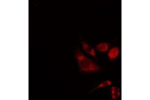 ABIN6276291 staining 293 cells by IF/ICC. (BAK1 抗体  (N-Term))