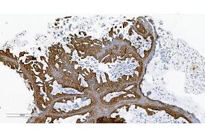 IHC analysis of PLTP using anti-PLTP antibody (ABIN7600346). (PLTP 抗体  (AA 18-470))