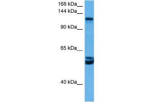 Host:  Rabbit  Target Name:  RBL2  Sample Tissue:  Mouse Brain  Antibody Dilution:  1ug/ml (p130 抗体  (C-Term))