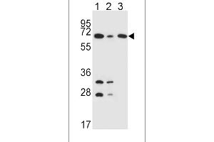 DLAT Antibody (C-term) (ABIN651534 and ABIN2840283) western blot analysis in K562(lane 1),HepG2(lane 2),Jurkat(lane 3) cell line lysates (35 μg/lane). (DLAT 抗体  (C-Term))