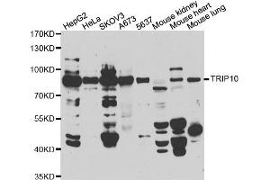 Western blot analysis of extracts of various cell lines, using TRIP10 antibody. (TRIP10 抗体)