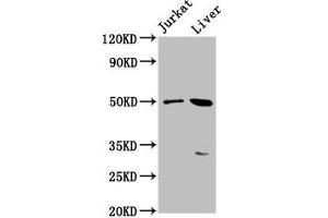 Western Blot Positive WB detected in: Jurkat whole cell lysate, Mouse liver tissue All lanes: BPIFB3 antibody at 3. (BPIFB3 抗体  (AA 248-352))
