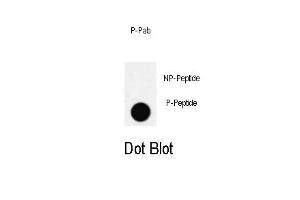 Dot blot analysis of PDX1 Antibody (T11) Pab (ABIN650810 and ABIN2839791) on nitrocellulose membrane. (PDX1 抗体  (pThr11))